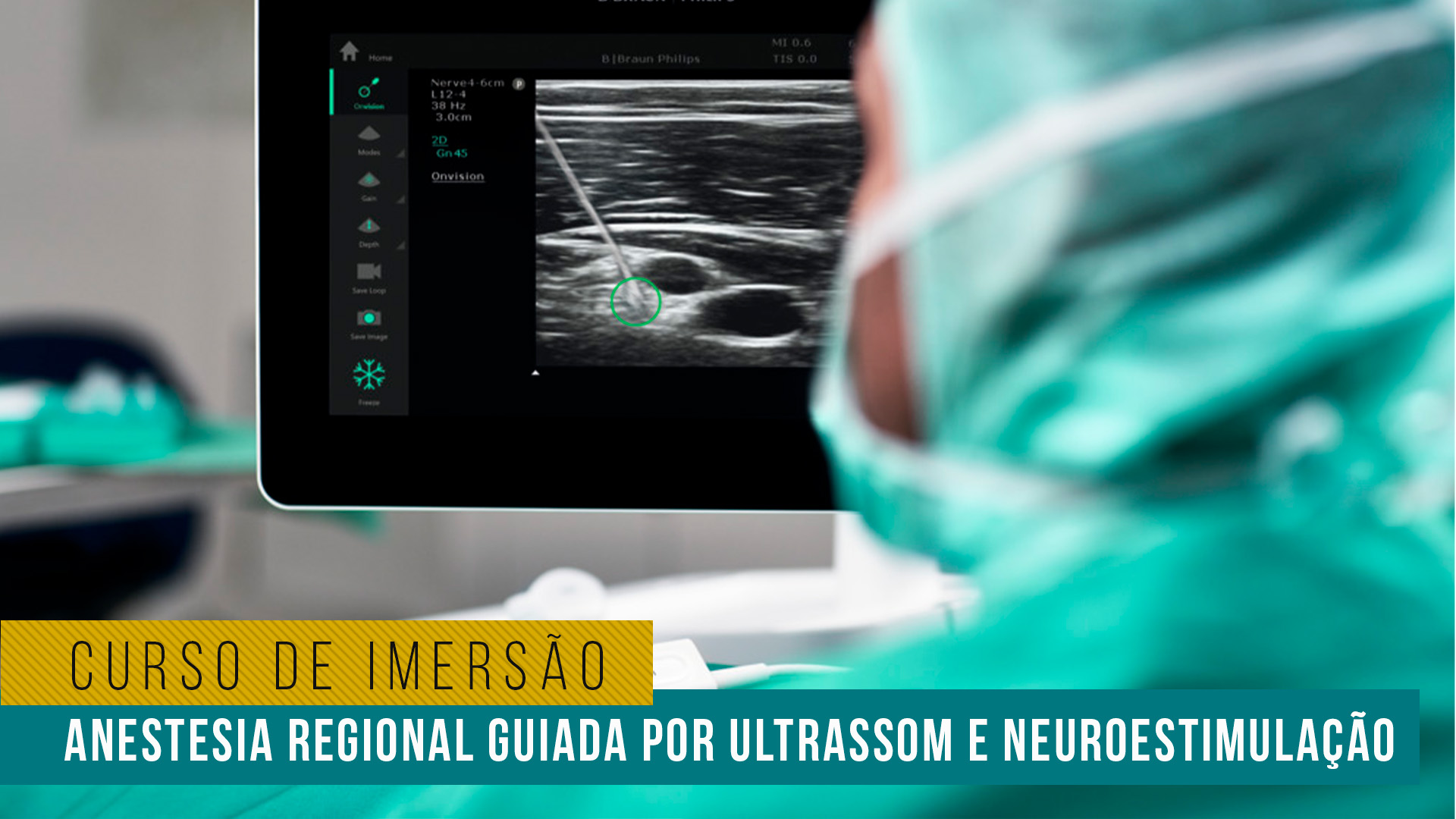 Curso de Imersão em Anestesia Regional Guiada por Ultrassom e Neuroestimulação